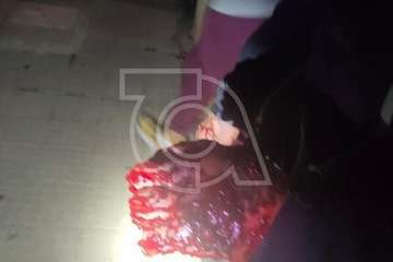 Tiroteo en Lomo de las Brujas de Jinámar con dos heridos/TA.